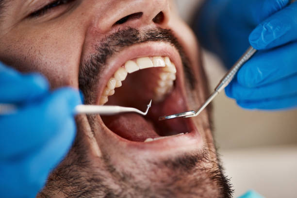 Best Chipped Tooth Repair Near Me  in Aberdeen Proving Ground, MD